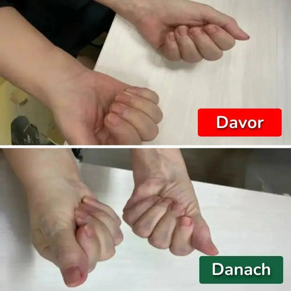 Nervio-Handgelenksstütze